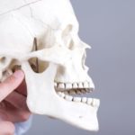 ズレた顎の位置を正しい位置に戻す治療用義歯
