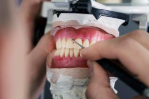 高松市で入れ歯をお探しなら入れ歯専門の吉本歯科医院